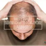 Best Hair Regrowth Oil for Baldness