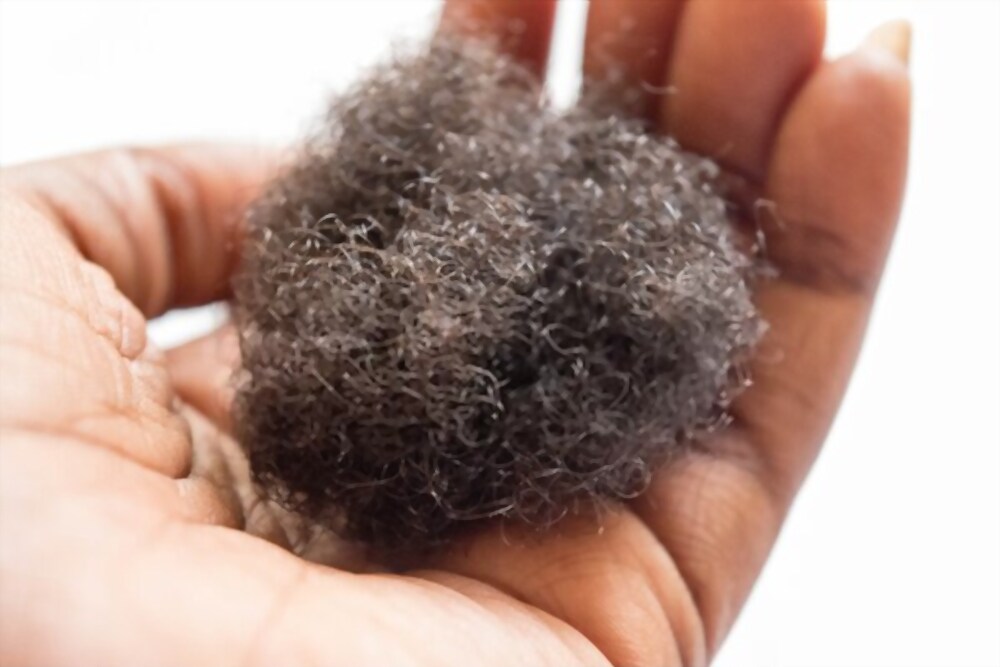 How to prevent hair loss in black men