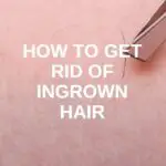 How To Get Rid Of Ingrown Hair
